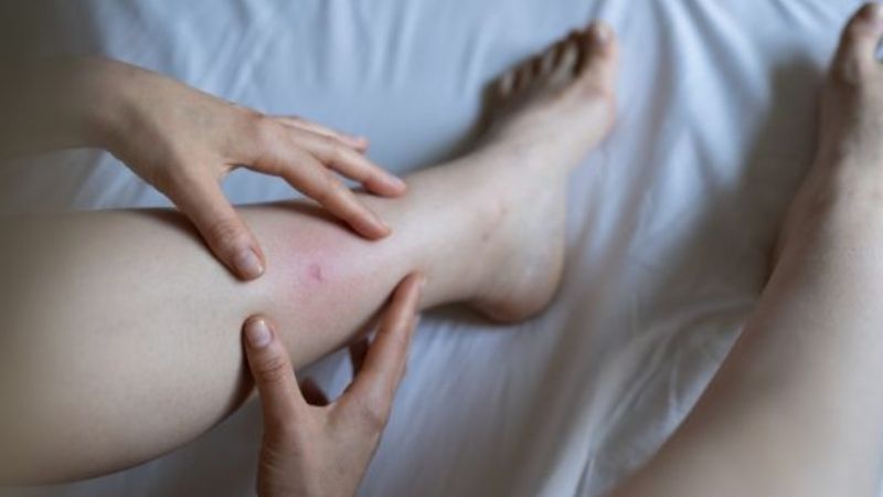 Bị gián cắn từ góc nhìn khoa học