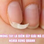Gãy Móng Tay Là Điềm Gì? Giải Mã Các Ý Nghĩa Xung Quanh