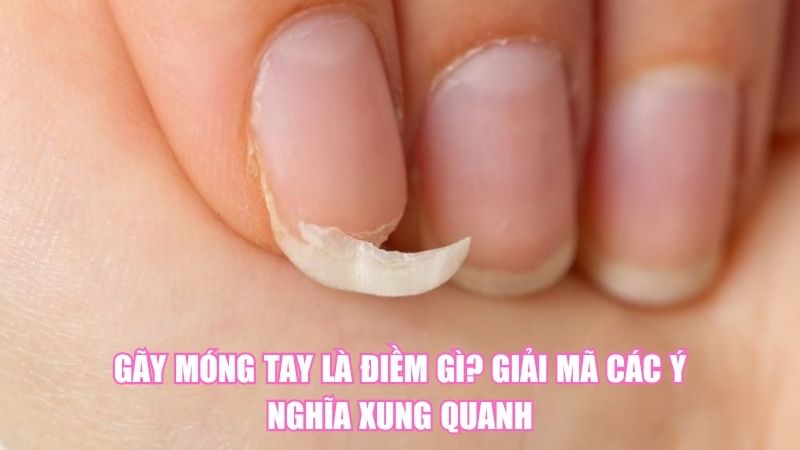 Gãy Móng Tay Là Điềm Gì? Giải Mã Các Ý Nghĩa Xung Quanh