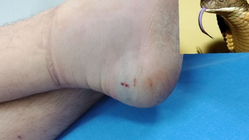 Nằm mơ thấy rắn cắn vào chân đánh con gì?