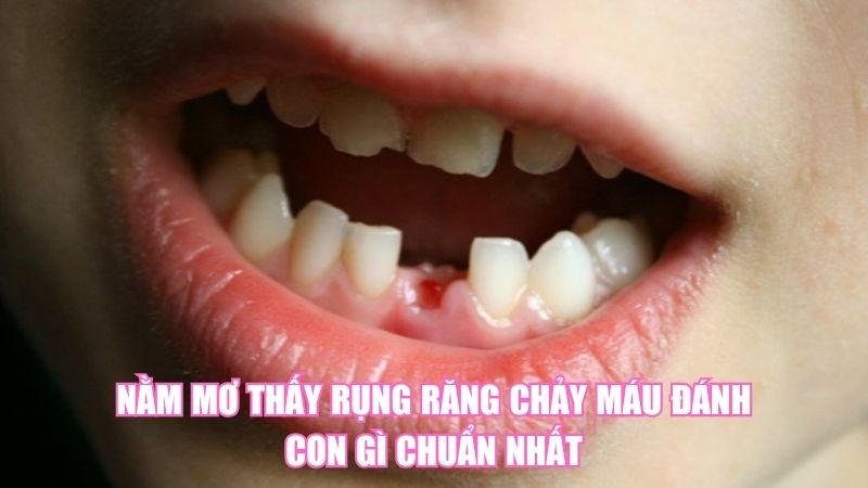Nằm Mơ Thấy Rụng Răng Chảy Máu Đánh Con Gì Chuẩn Nhất