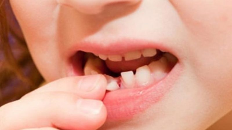 Nằm Mơ Thấy Rụng Răng Chảy Máu Đánh Con Gì?