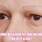 Rụng Lông Mi Là Điềm Gì? Giải Mã Dấu Hiệu Thú Vị Ít Ai Biết