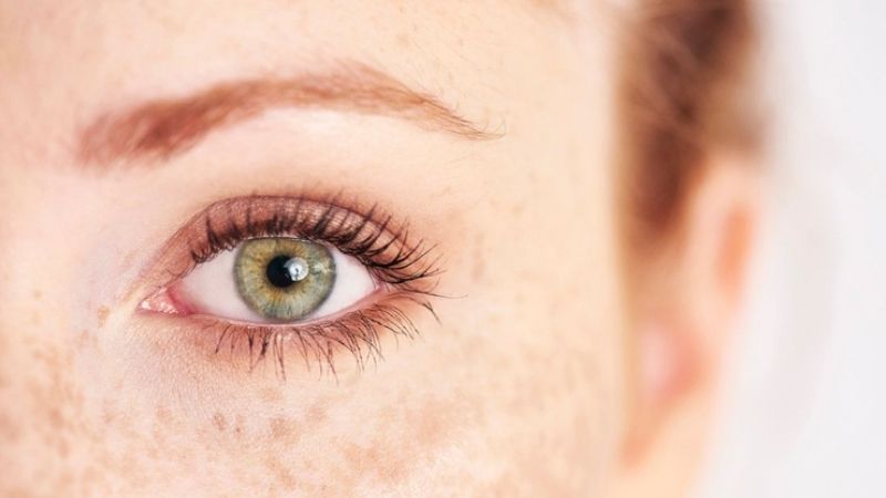 Rụng lông mi là điềm gì theo quan niệm dân gian?