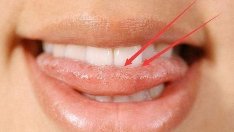 Giải mã cắn vào lưỡi là điềm gì theo thời điểm xảy ra