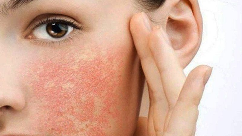 Khi nào nên lo lắng về tình trạng ngứa mặt?