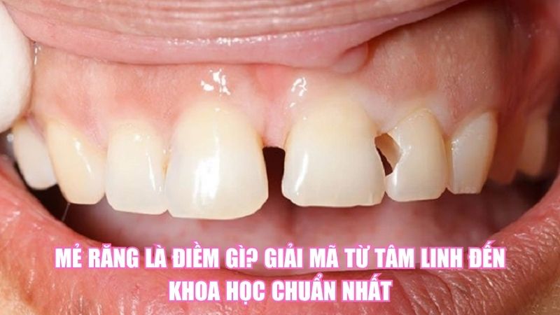 Mẻ Răng Là Điềm Gì? Giải Mã Từ Tâm Linh Đến Khoa Học Chuẩn Nhất