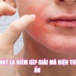 Ngứa Mặt Là Điềm Gì? Giải Mã Hiện Tượng Bí Ẩn