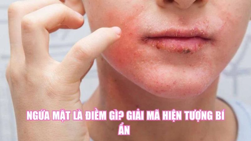 Ngứa Mặt Là Điềm Gì? Giải Mã Hiện Tượng Bí Ẩn
