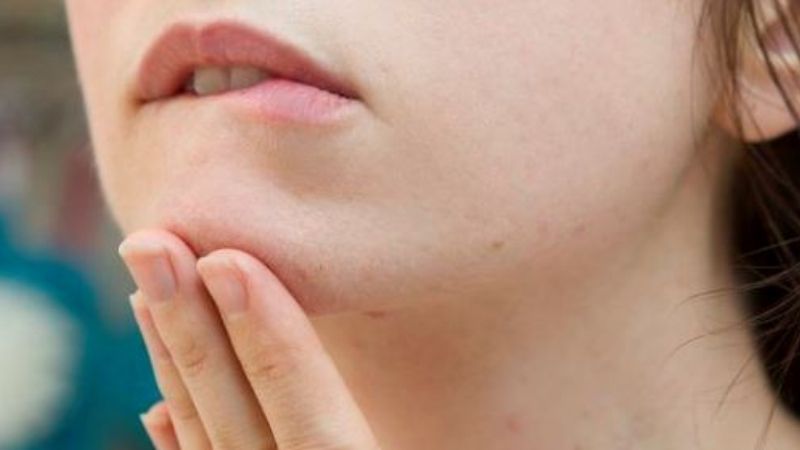 Ngứa mặt là điềm gì theo quan niệm dân gian?