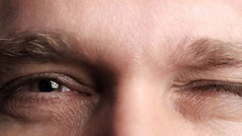 Tìm hiểu hiện tượng chân mày giật