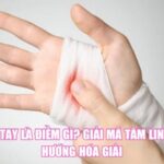Đứt Tay Là Điềm Gì? Giải Mã Tâm Linh Và Hướng Hóa Giải