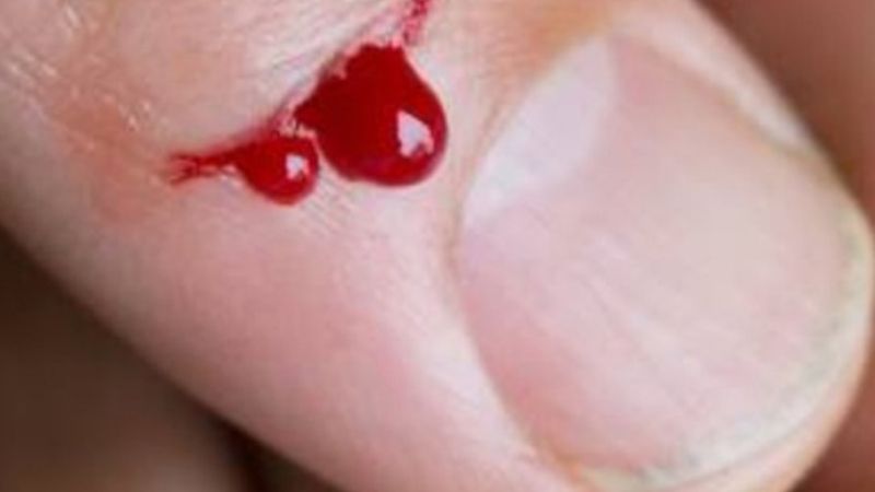 Giải Mã Chi Tiết: Đứt Tay Là Điềm Gì Theo Từng Trường Hợp