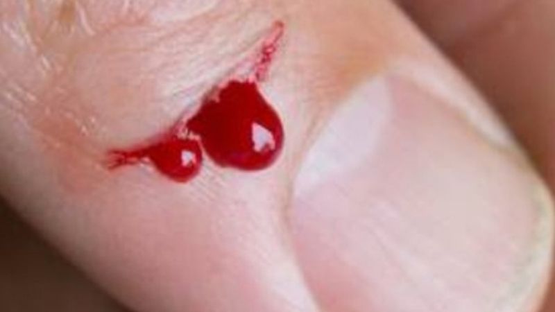 Mơ Thấy Máu Đánh Con Gì?