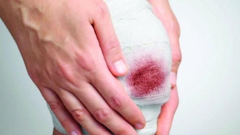 Mơ Thấy Máu Là Điềm Báo Gì? Tốt Hay Xấu?